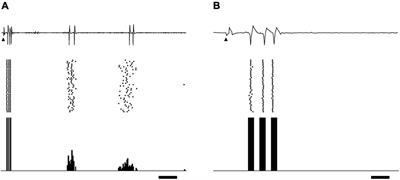 Spatial Resolution of Suprachoroidal–Transretinal Stimulation Estimated by Recording Single-Unit Activity From the Cat Lateral Geniculate Nucleus